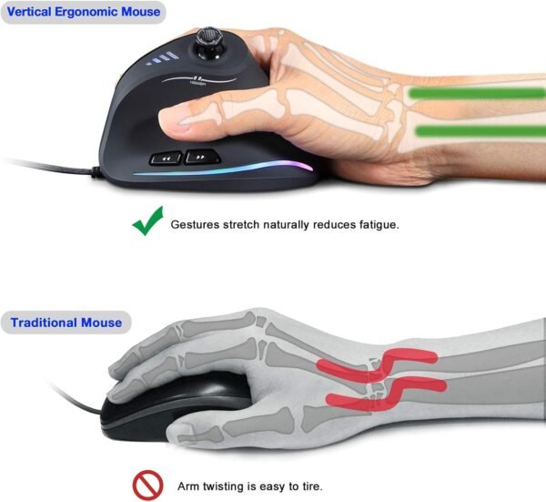 TRELC Mouse para jogos com 5 D Rocker, mouse ergonômico com 10.000 DPI/11 botões programáveis, mouse vertical para jogos com fio para PC/laptop/e-Sports/Gamer (preto) - Imagem 3