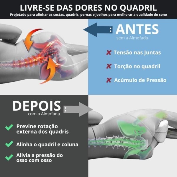 Travesseiro Almofada De Pernas Ortopédico Alivia Dores No Corpo Lombar, Ciática, Articulações, Joelhos e Gravidez - Espuma de Memória - Imagem 3